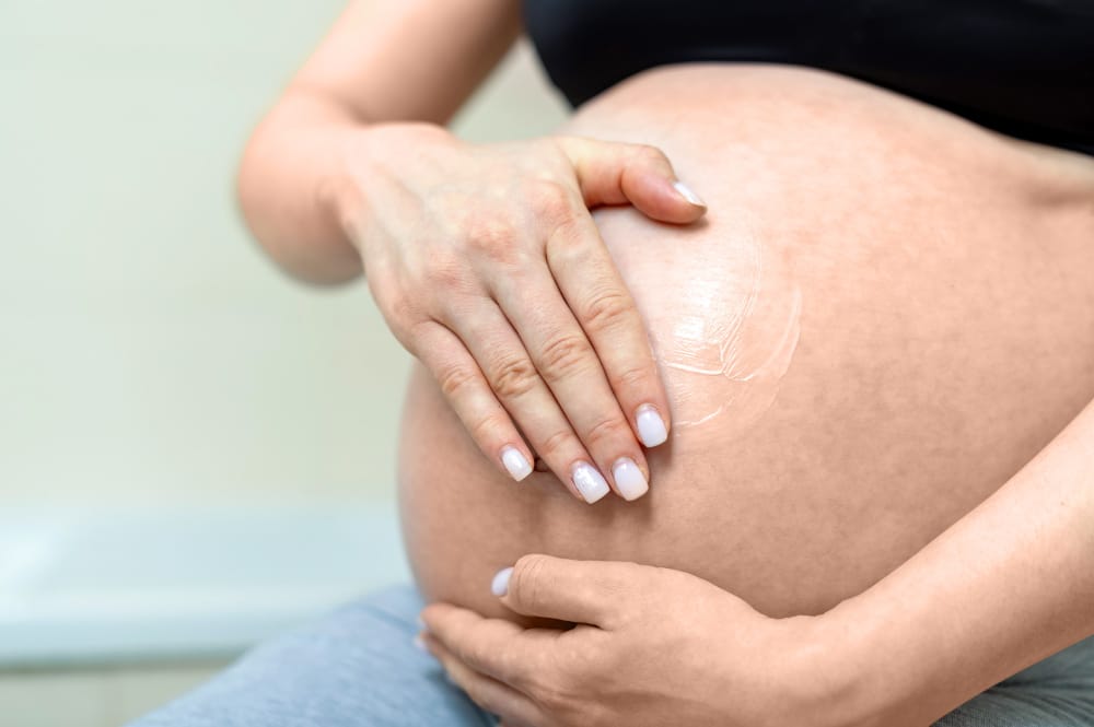 Evitar estrias na gravidez é possível? 4 Evitar estrias na gravidez 2