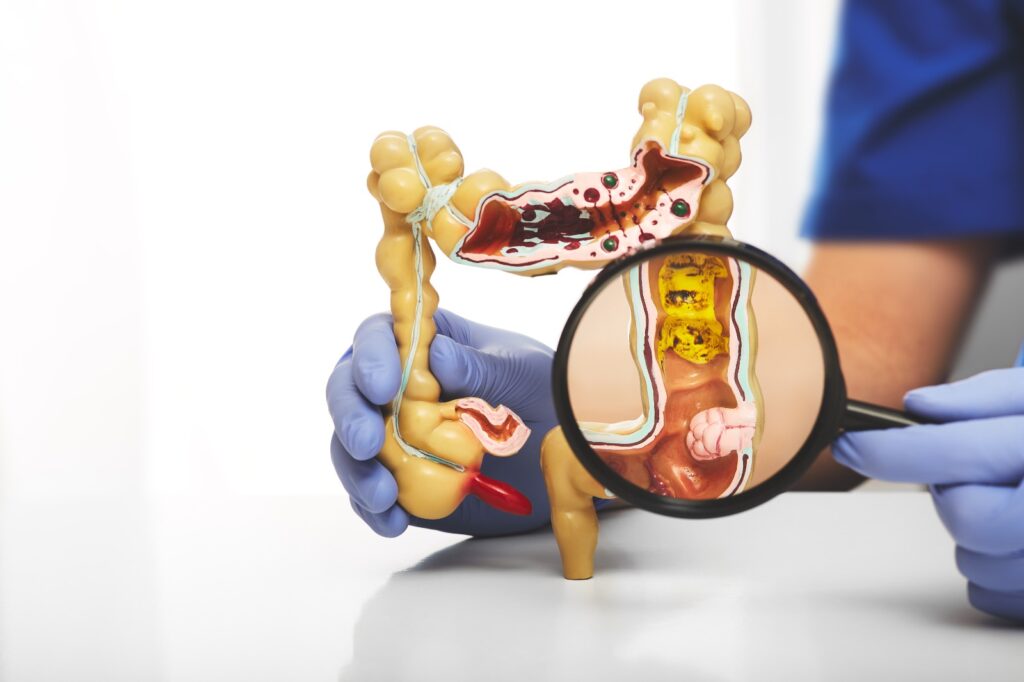 A importância da saúde intestinal para o bem-estar geral 1 saúde intestinal